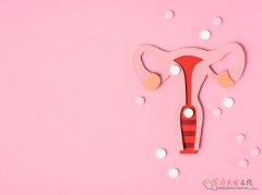 肾阴虚会导致白带发黄吗？真相解析