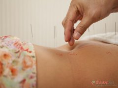 经期艾灸肚脐：3种情况科学判断，避免不适