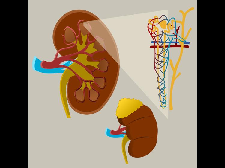 肾阴虚会导致脸色发黑发黄吗？中医解读与应对指南