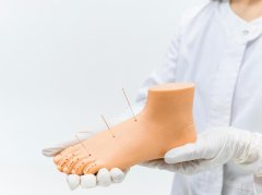 痔疮发作别慌，3个艾灸穴位可辅助缓解症状