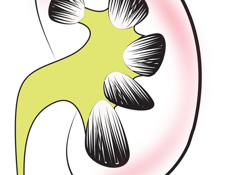 腰酸耳鸣总缠身？可能是肾虚在“报警”