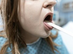 舌苔白≠痰湿证！4种原因帮你分清