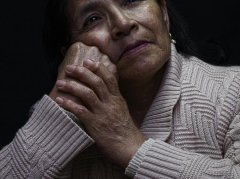 老年斑中医辨证饮食调理：内养改善肌肤状态