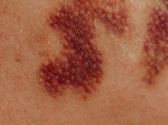 大黄调理瘀血证：3个核心作用+科学使用指南