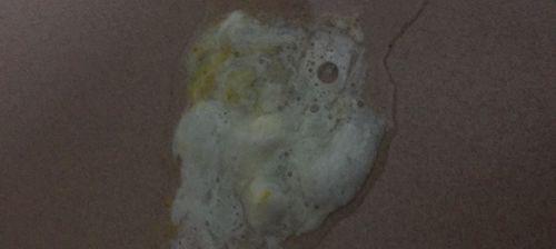 狗鼻子有白色鼻涕的原因解析（了解狗鼻子白色鼻涕的成因和应对方法）