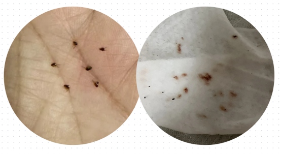 猫身上有虫的症状