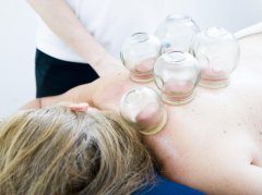 年轻人能拔罐吗？3个常见误解帮你避开风险