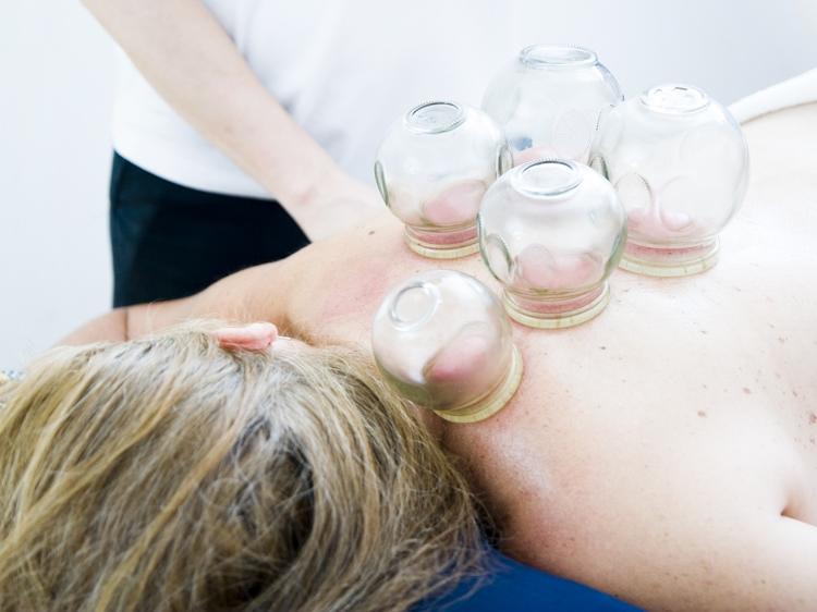 年轻人能拔罐吗？3个常见误解帮你避开风险