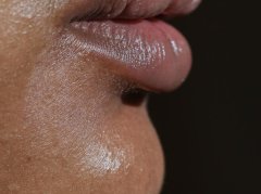 嘴唇干裂脱皮？别只怪肾阴虚！3根源+避坑指南润到爆