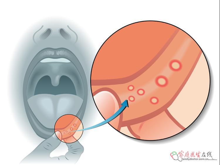 舌头中间发红?3种健康信号预警,教你区分调理 舌头中间发红?3种健康信号预警,教你区分调理