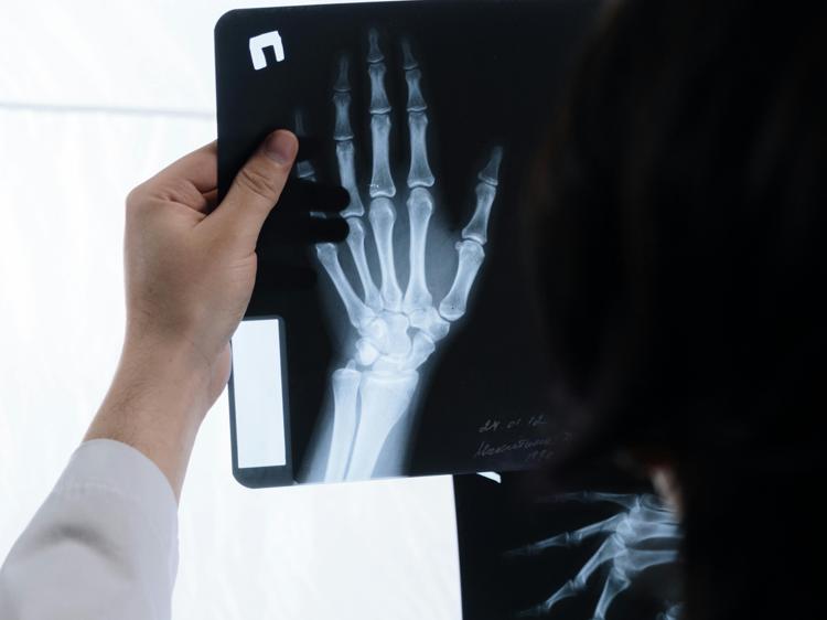 骨折愈合别靠感觉！科学判断避免二次损伤