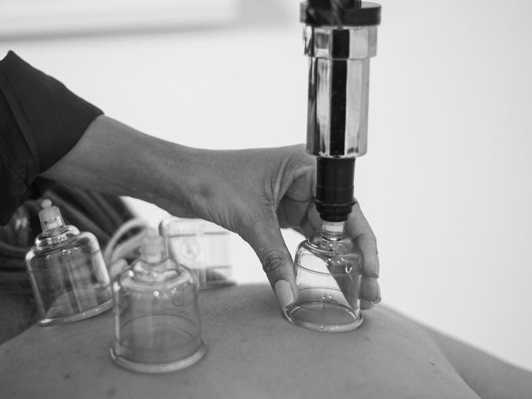 拔罐无最佳时间？找准适应症避开禁忌是关键