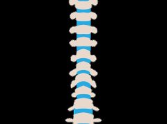 男性腰疼别硬扛？4种病因及科学应对方法