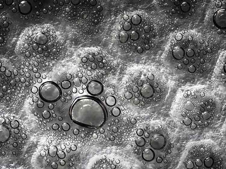 拔罐后水泡颜色有讲究?读懂信号避免盲目焦虑 拔罐后水泡颜色有讲究?读懂信号避免盲目焦虑