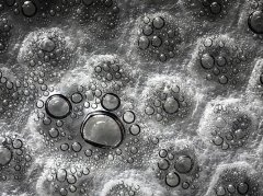 拔罐后水泡颜色有讲究？读懂信号避免盲目焦虑