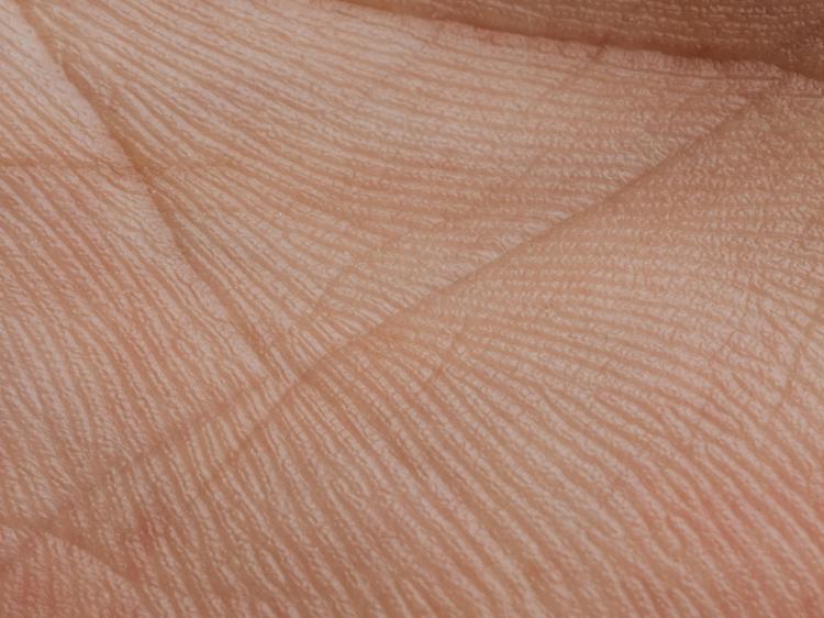 手掌光滑是肝肾亏虚?别被误导!3个科学判断法 手掌光滑是肝肾亏虚?别被误导!3个科学判断法