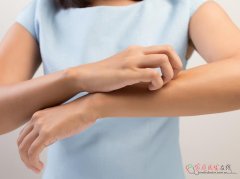 血热证致皮肤痒：中西医解析+科学应对方案
