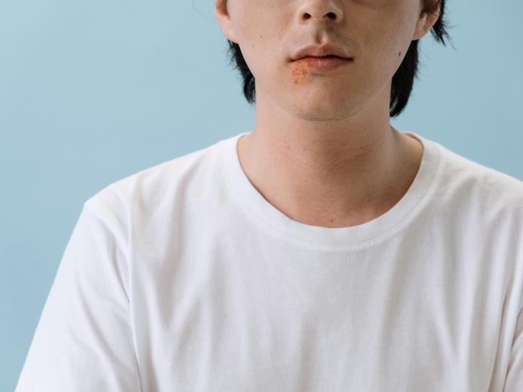 肾阴虚会引发口腔溃疡？中医教你科学调理不踩坑