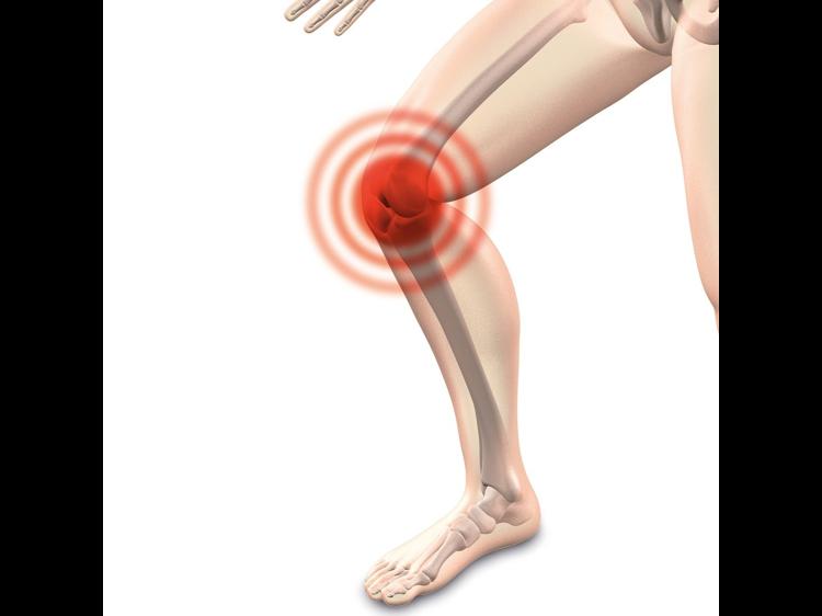 风湿热痹是什么？教你正确识别与应对