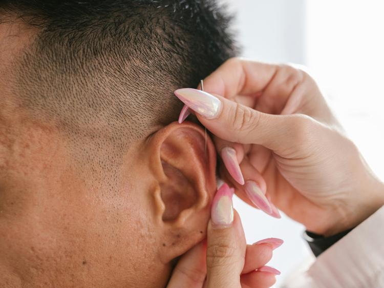 王不留行籽耳贴改善失眠：原理与注意事项详解