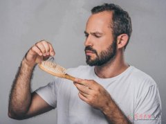 18岁男孩雄激素性脱发：中医调理+生活管理指南