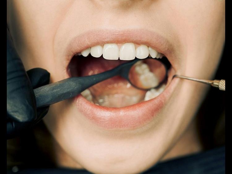 牙龈萎缩与肾虚有关吗？中西医结合调理方法帮你改善