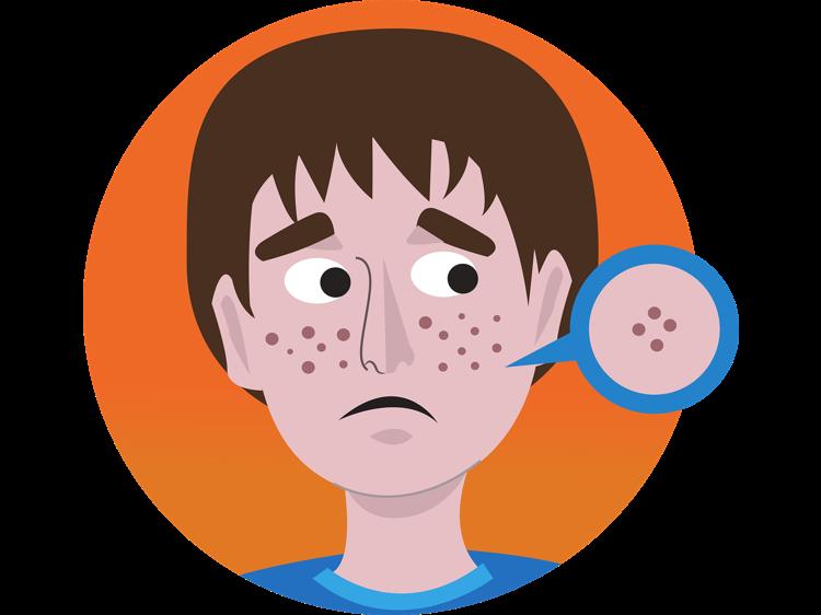 黄褐斑别只靠外抹，科学内调这样做淡化色斑更有效