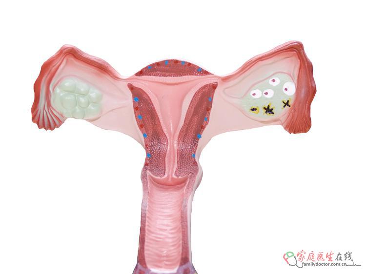 中医调理子宫内膜增生：科学方法与注意事项详解