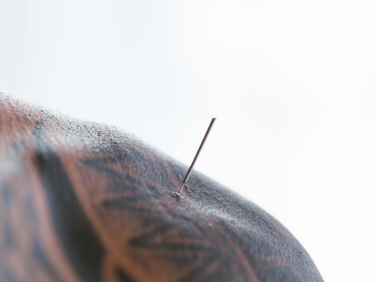 中医调理糖尿病周围神经病变：科学控并发症指南