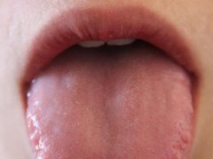 舌苔异常两三月？3个健康预警信号+科学应对指南