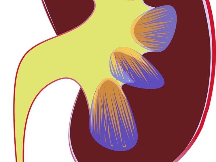 中医辨证治尿路感染：3证型方案助缓解不适降低复发