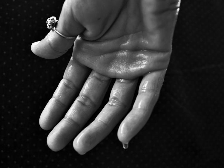 寒湿体质手心多汗发凉？科学识别与调理指南