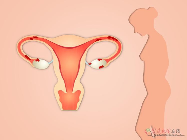 当归调月经不调：科学用对才有效，避开3大误区