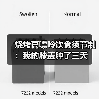 烧烤高嘌呤饮食须节制：我的膝盖肿了三天（图1）